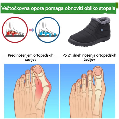 🔥Današnja posebna ponudba: 70 % popust!⏰ - Zimski škornji Vernoan®, luksuzni italijanski ortopedski čevlji iz semiša. 👍Opora za stopalski lok, poslovite se od bolečin v stopalih.