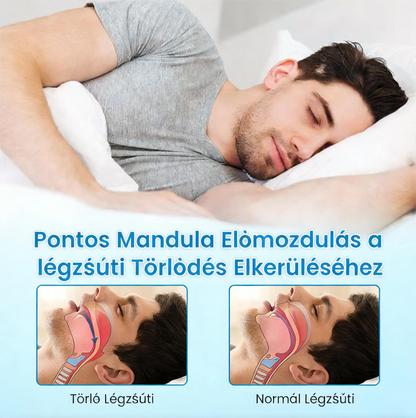 🎁Vásárolj egyet, kapsz egyet ingyen😴 Flanora horkolásgátló készülék