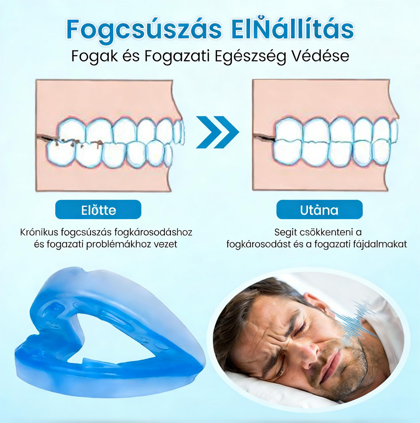 🎁Vásárolj egyet, kapsz egyet ingyen😴 Flanora horkolásgátló készülék