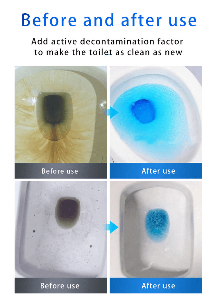 🚽 Kup więcej, otrzymaj więcej-ŚRODEK DO CZYSZCZENIA ODPŁYWÓW ZLEWÓW